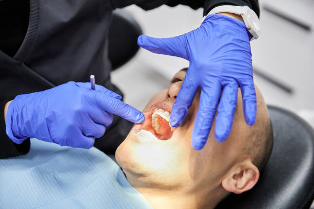 Best Broken or Cracked Tooth Emergency Dentist in Lafayette, OR