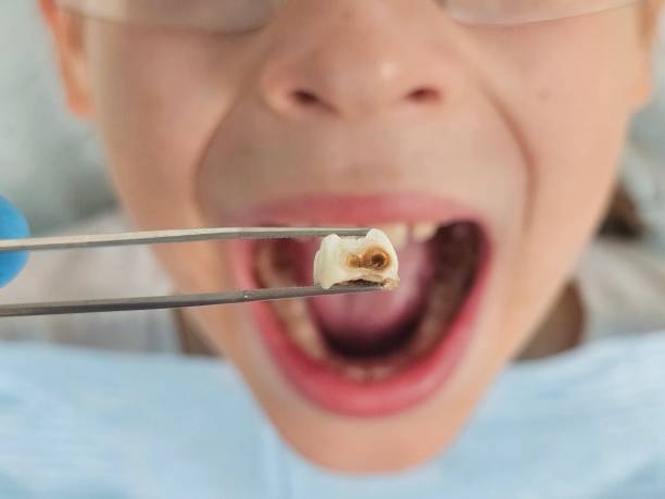 Best Pediatric Emergency Dentist in Lafayette, OR